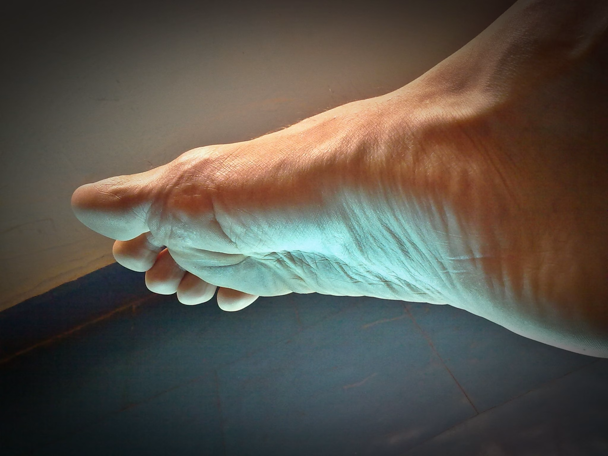 Smerter under hælen – hva er plantar fascitt, og når bør du oppsøke ortoped?